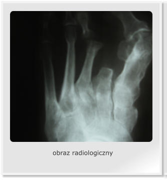 obraz radiologiczny